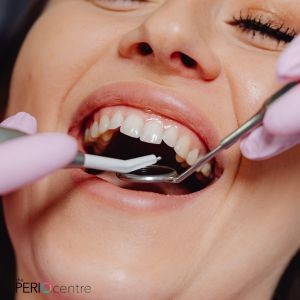 gum disease treatment