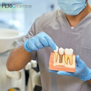 dental-implants-whitby