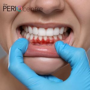 gum grafting periodontal treatment