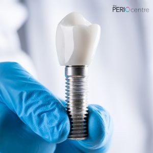dental implants oshawa