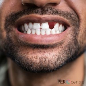 dental implants whitby