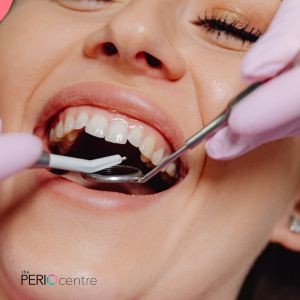 gum disease treatment from periodontist