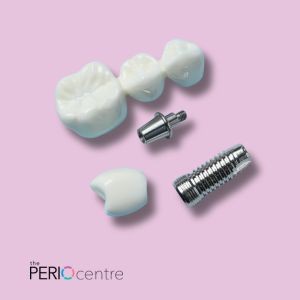 dental implants periodontist Oshawa